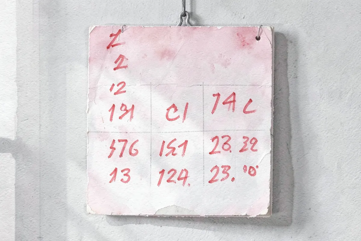 Calendário com dias marcados em vermelho indicando o período de recuperação pós-cirúrgica.