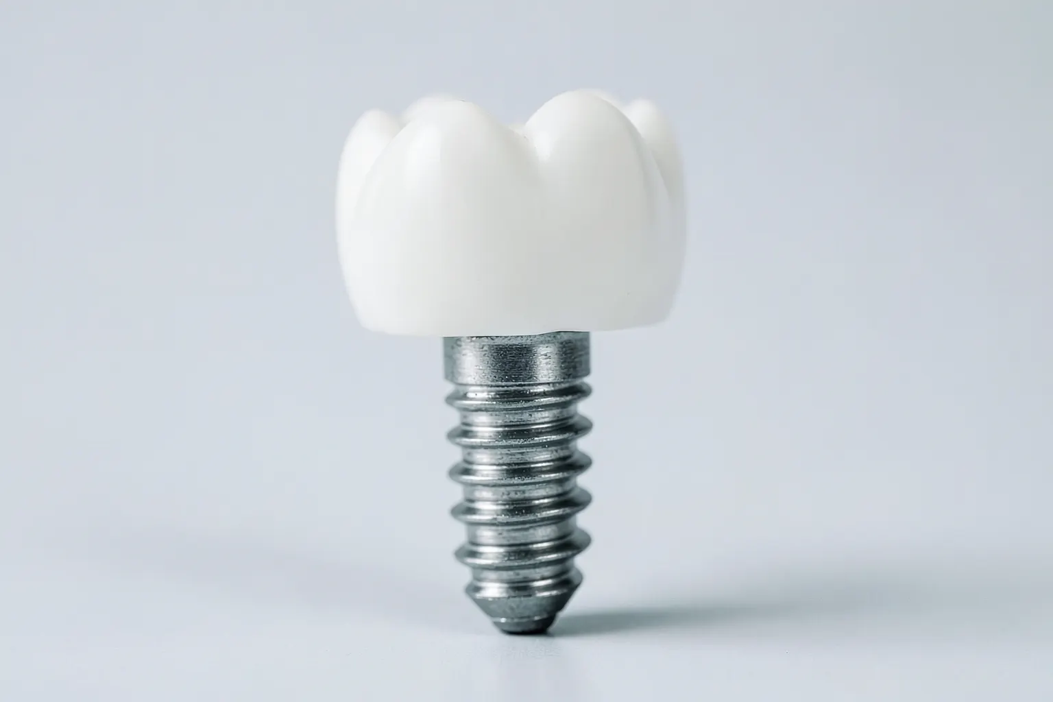 Implante dentário em close-up, mostrando a estrutura metálica e o dente artificial sobre um fundo branco.