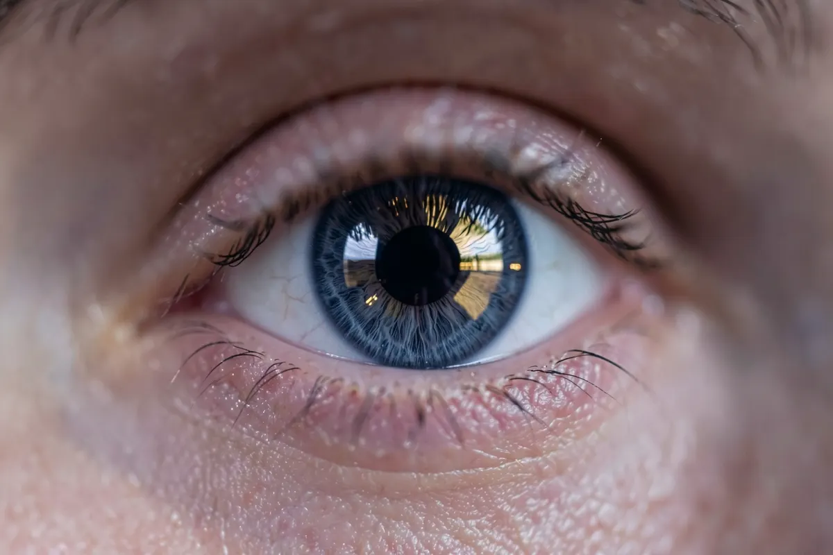 olho com reflexo de gráfico de recuperação em alta, cirurgia refrativa