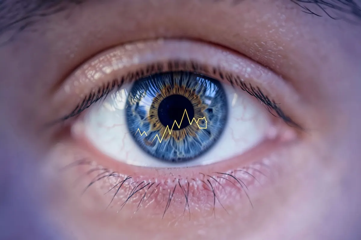 olho com reflexo de gráfico de recuperação em alta, cirurgia refrativa